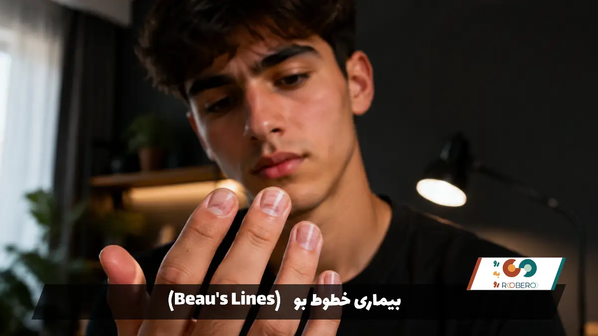 بیماری خطوط بو (Beau’s Lines)