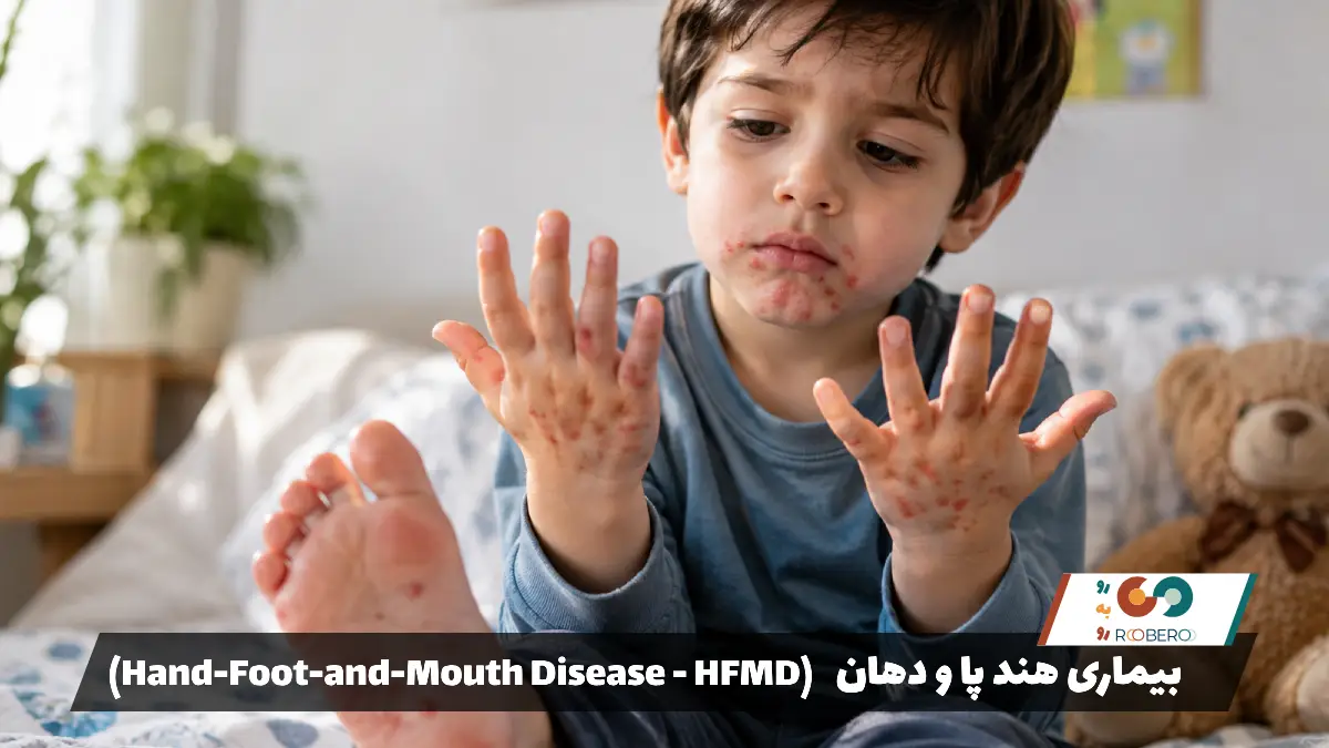 بیماری هند پا و دهان (Hand-Foot-and-Mouth Disease – HFMD)