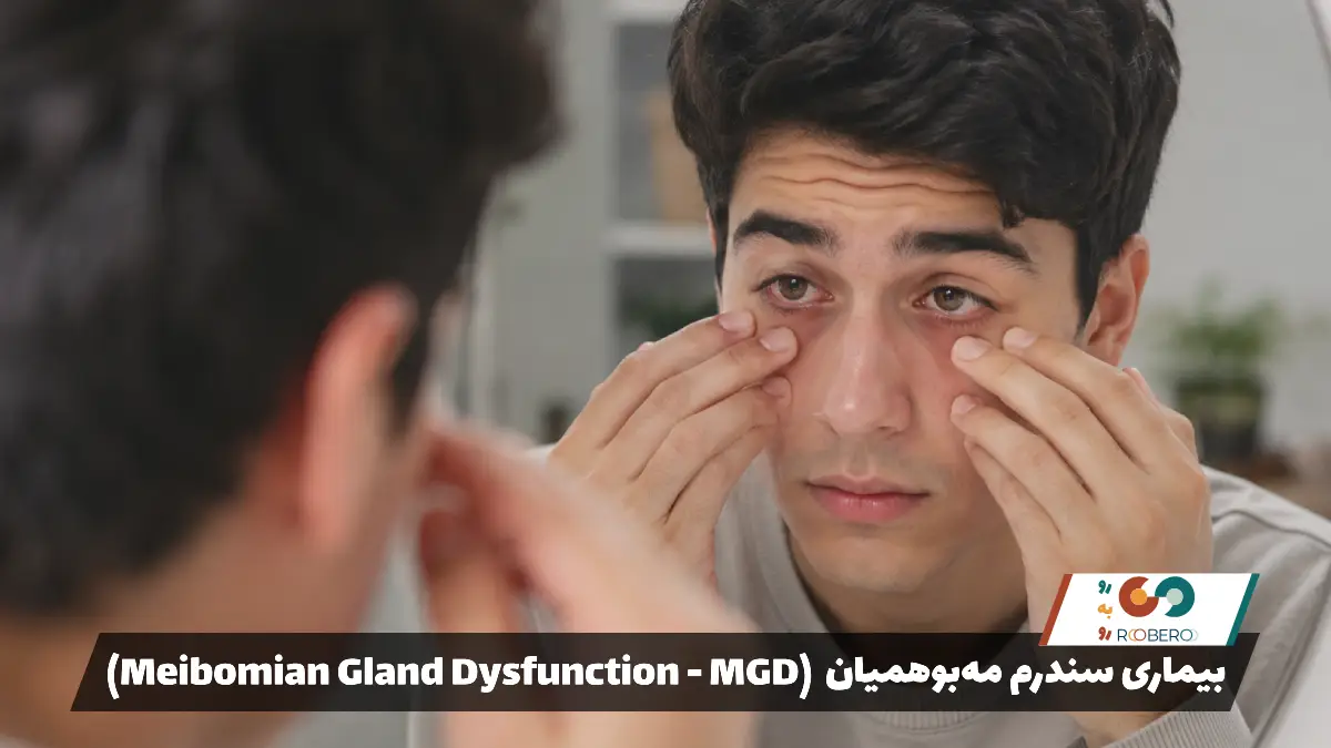 بیماری‌ سندرم مه‌بوهمیان (Meibomian Gland Dysfunction – MGD)